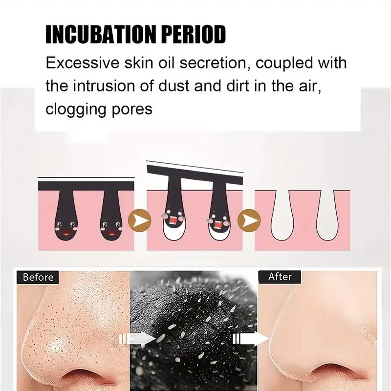 Nose Blackhead Remove Mask Plaster Nose Strips Remove Blackheads Pores Black Dot Remover Acne Peel Mask Cleaning Patch Skin Care