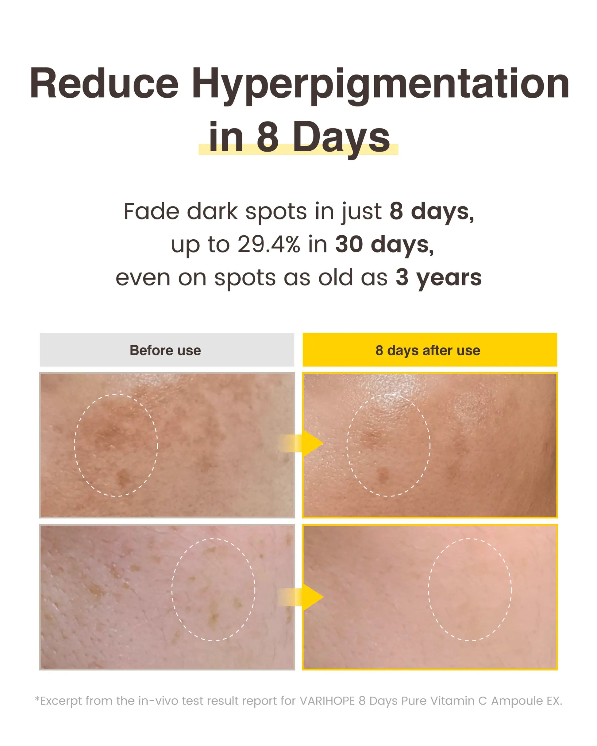 8 Days Vitamin C Serum