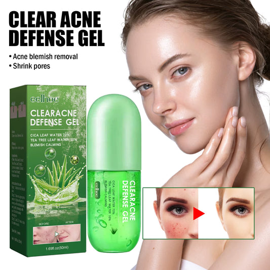 Aloe Soothing Gel Acne Treatment Shrink Pores Pimple Removal Oil Control Fade Blemish Marks Moisturizing Improve Peelings Cream